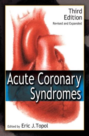 Acute Coronary Syndromes By Eric J Topol