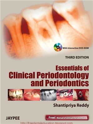 Essentials of Clinical Periodontology and Periodontics 3rd Edition