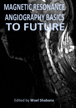 Magnetic Resonance Angiography Basics to Future