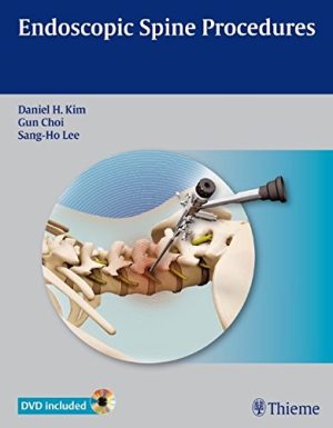 Endoscopic Spine Procedures