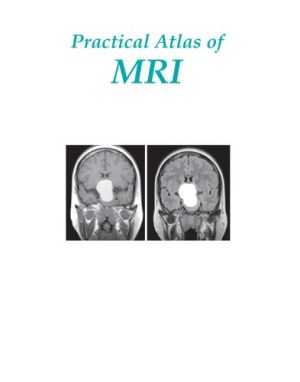 Practical Atlas of MRI