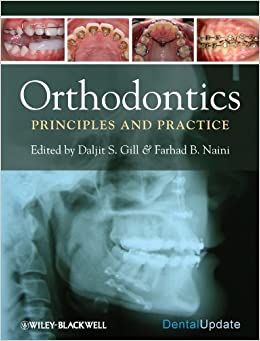 Orthodontics Principles And Practice