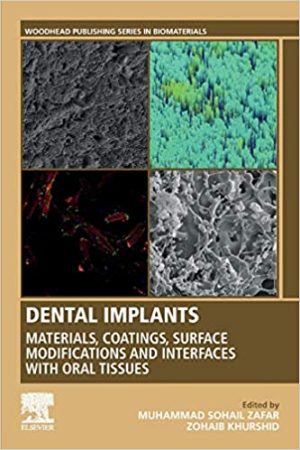 Dental Implants Materials Coatings Surface Modifications and Interfaces with Oral Tissues