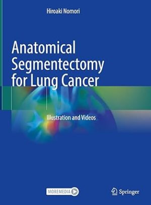Anatomical Segmentectomy for Lung Cancer Illustration and Videos