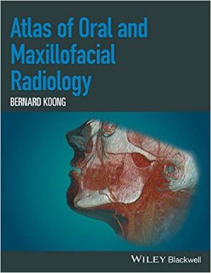 Atlas Of Oral And Maxillofacial Radiology