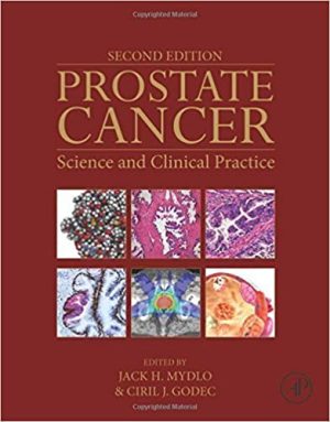 Prostate Cancer Science and Clinical Practice 2nd Edition