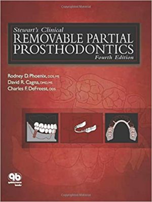 Stewart’s Clinical Removable Partial Prosthodontics 4th Edition