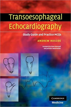 Transoesophageal Echocardiography Study Guide and Practice MCQs