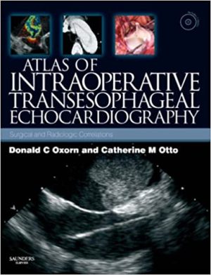 Atlas of Intraoperative Transesophageal Echocardiography