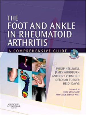 The Foot and Ankle in Rheumatoid Arthritis A Comprehensive Guide