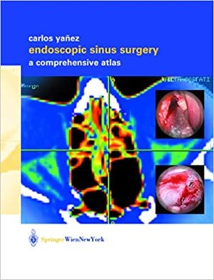 Endoscopic Sinus Surgery A Comprehensive Atlas