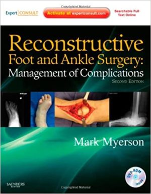 Reconstructive Foot and Ankle Surgery Management of Complications 2nd Edition