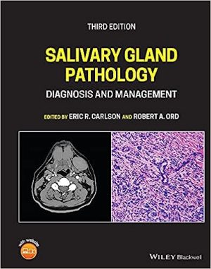 Salivary Gland Pathology Diagnosis and Management