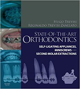 State Of The Art Orthodontics Self Ligating Appliances Miniscrews And Second Molars Extraction