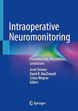Intraoperative Neuromonitoring Fundamentals Possibilities Limitations