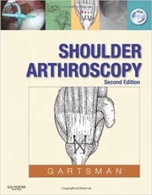 Shoulder Arthroscopy 2nd Ed