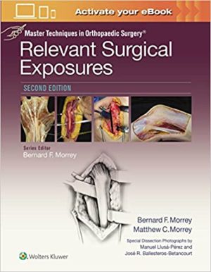 Master Techniques in Orthopaedic Surgery Relevant Surgical Exposures 2nd Edition