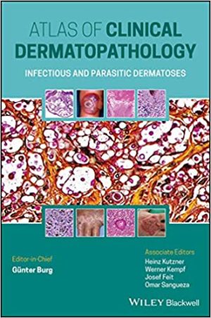 Atlas of Clinical Dermatopathology Infectious and Parasitic Dermatoses