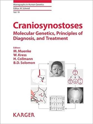 Craniosynostoses Molecular Genetic Principles of Diagnosis and Treatment