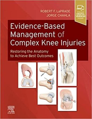 Evidence Based Management of Complex Knee Injuries Restoring the Anatomy to Achieve Best Outcomes