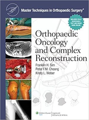 Master Techniques in Orthopaedic Surgery Orthopaedic Oncology and Complex Reconstruction