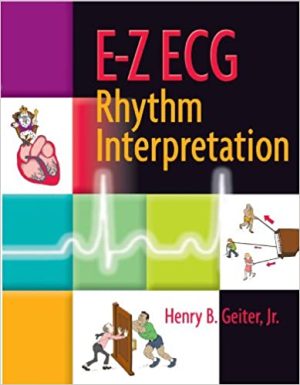 E Z ECG rhythm interpretation