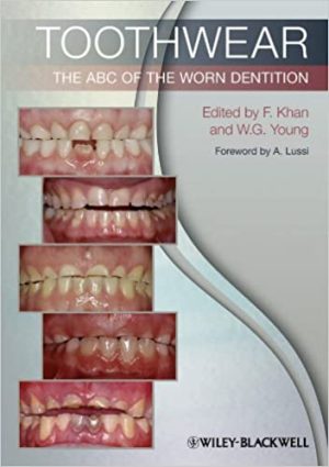 Toothwear The ABC Of The Worn Dentition