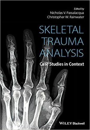 Skeletal Trauma Analysis Case Studies in Context