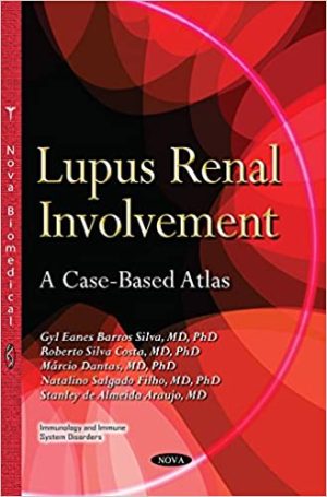 Lupus Renal Involvement A Case Based Atlas