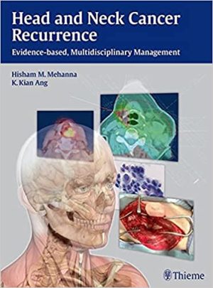 Head and Neck Cancer Recurrence Evidence based Multidisciplinary Management