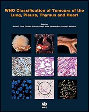 WHO Classification of Tumours of the Lung Pleura Thymus and Heart 4th Edition