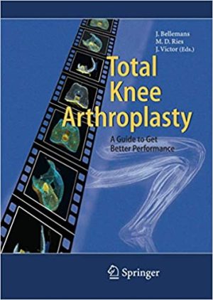Total Knee Arthroplasty A Guide to Get Better Performance