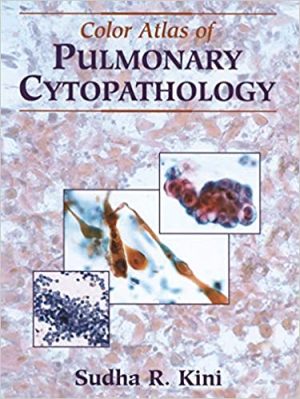 Color Atlas of Pulmonary Cytopathology