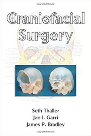 Craniofacial Surgery By Seth Thaller