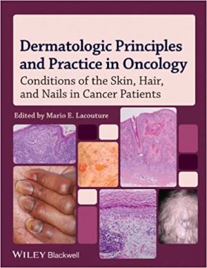 Dermatologic Principles and Practice in Oncology Conditions of the Skin Hair and Nails in Cancer Patients