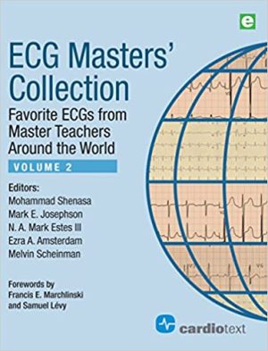 ECG Masters Collection Volume 2 Favorite ECGs from Master Teachers Around the World