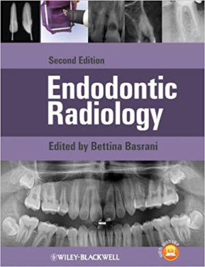 Endodontic Radiology 2nd Ed