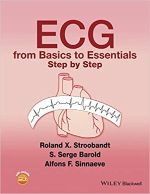 ECG from Basics to Essentials Step by Step