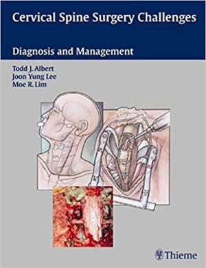 Cervical Spine Surgery Challenges Diagnosis And Management