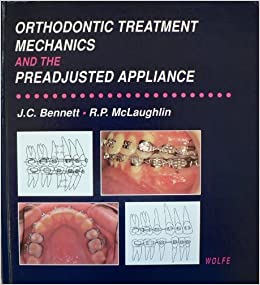 Orthodontic Treatment Mechanics and the Preadjusted Appliance