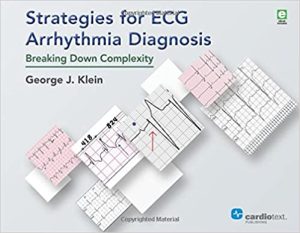 Strategies for ECG Arrhythmia Diagnosis Breaking Down Complexity