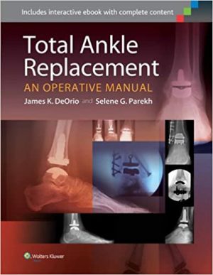 Total Ankle Replacement An Operative Manual