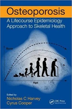 Osteoporosis A Lifecourse Epidemiology Approach to Skeletal Health