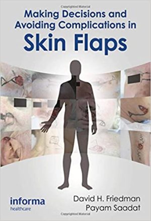 Making Decisions and Avoiding Complications in Skin Flaps