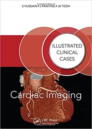 Cardiac Imaging Illustrated Clinical Cases