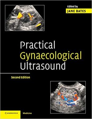 Practical Gynaecological Ultrasound