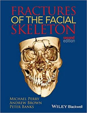Fractures of the Facial Skeleton By Peter Banks 2nd Edition