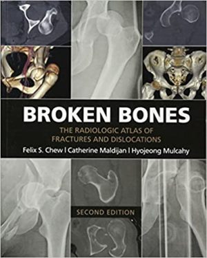 Broken Bones The Radiologic Atlas of Fractures and Dislocations 2nd Ed