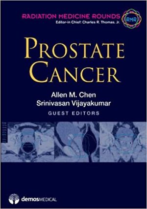 Prostate Cancer By Allen Chen