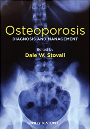 Osteoporosis Diagnosis and Management